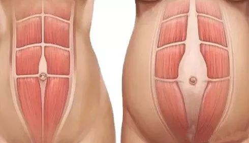 瘦腰神器对身体有害吗,瘦腰神器是真的有效果吗