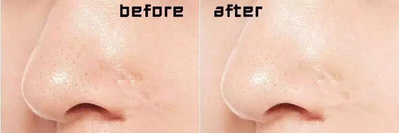 最近很火的鸡肋产品,看似很实用实则很鸡肋的产品