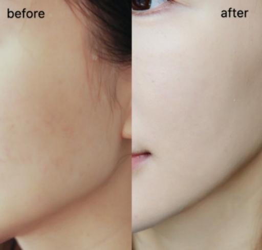 烟酰胺气垫粉底液,光感透润烟酰胺养肤粉底液