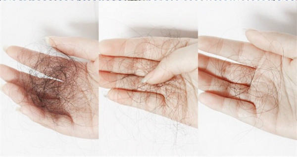 一个方法判断你是否有脱发,造成脱发的原因无非就这5个