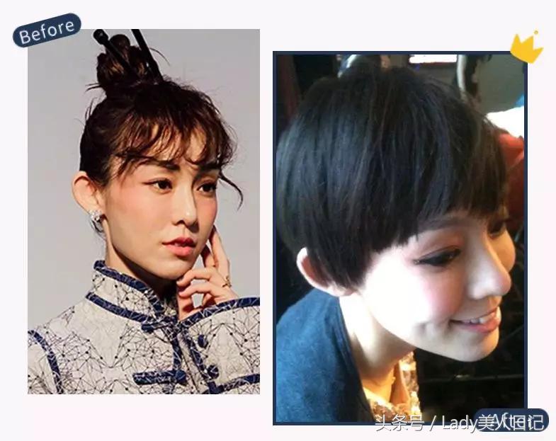 高级脸整容成功削骨,大脸削骨整容前后对比