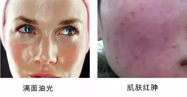 换季秋日肌肤焕活,秋日护肤水润先行