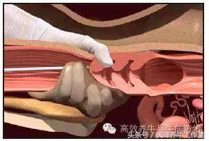 给母牛做人工授精教程,给牛人工授精的操作要领