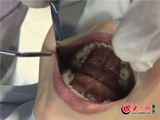 莱芜牙博士口腔联系电话,莱芜牙博士整牙要多少钱