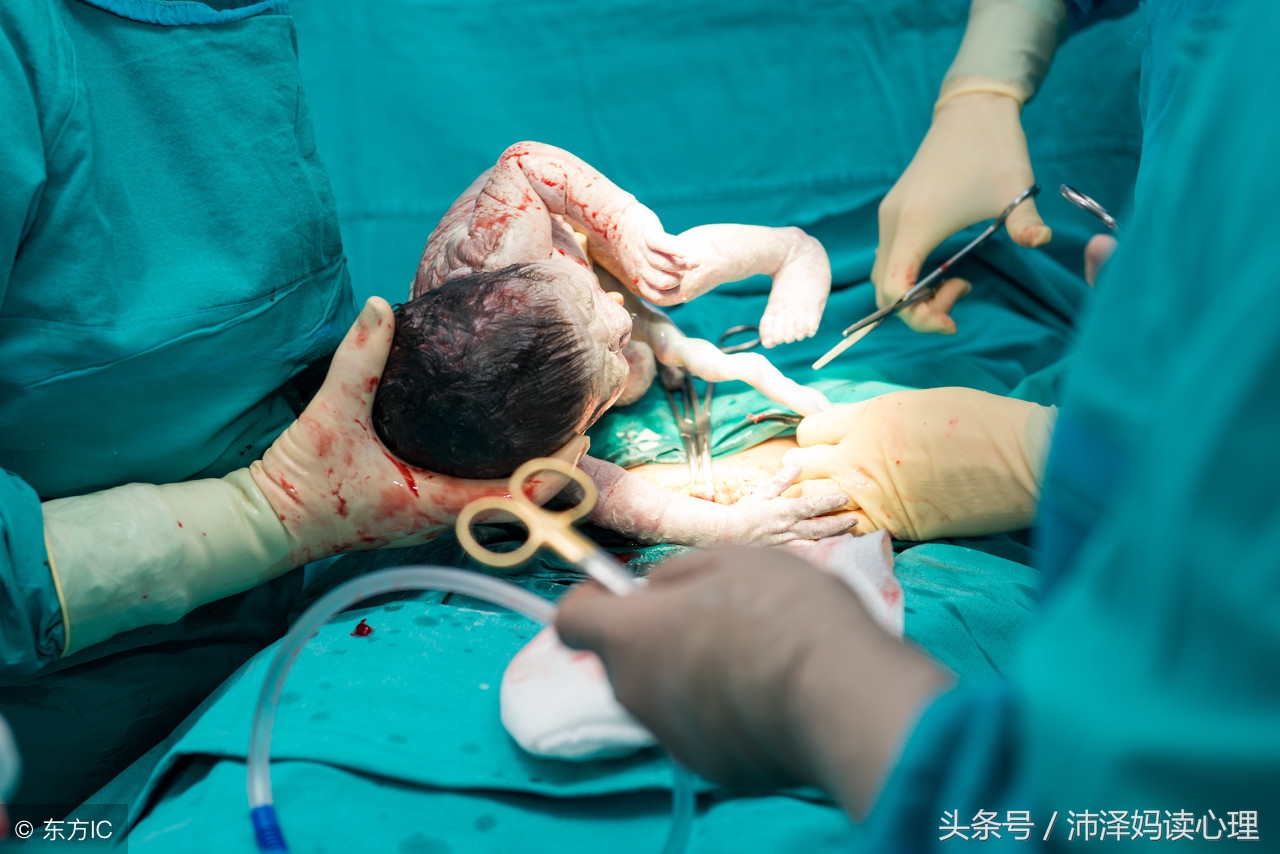 剖宫产与顺产最大区别,剖宫产和剖腹产的危险性