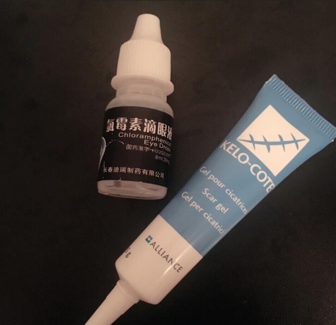 微创双眼皮开眼角3680元贵吗,纳米无痕双眼皮开眼角操作全过程