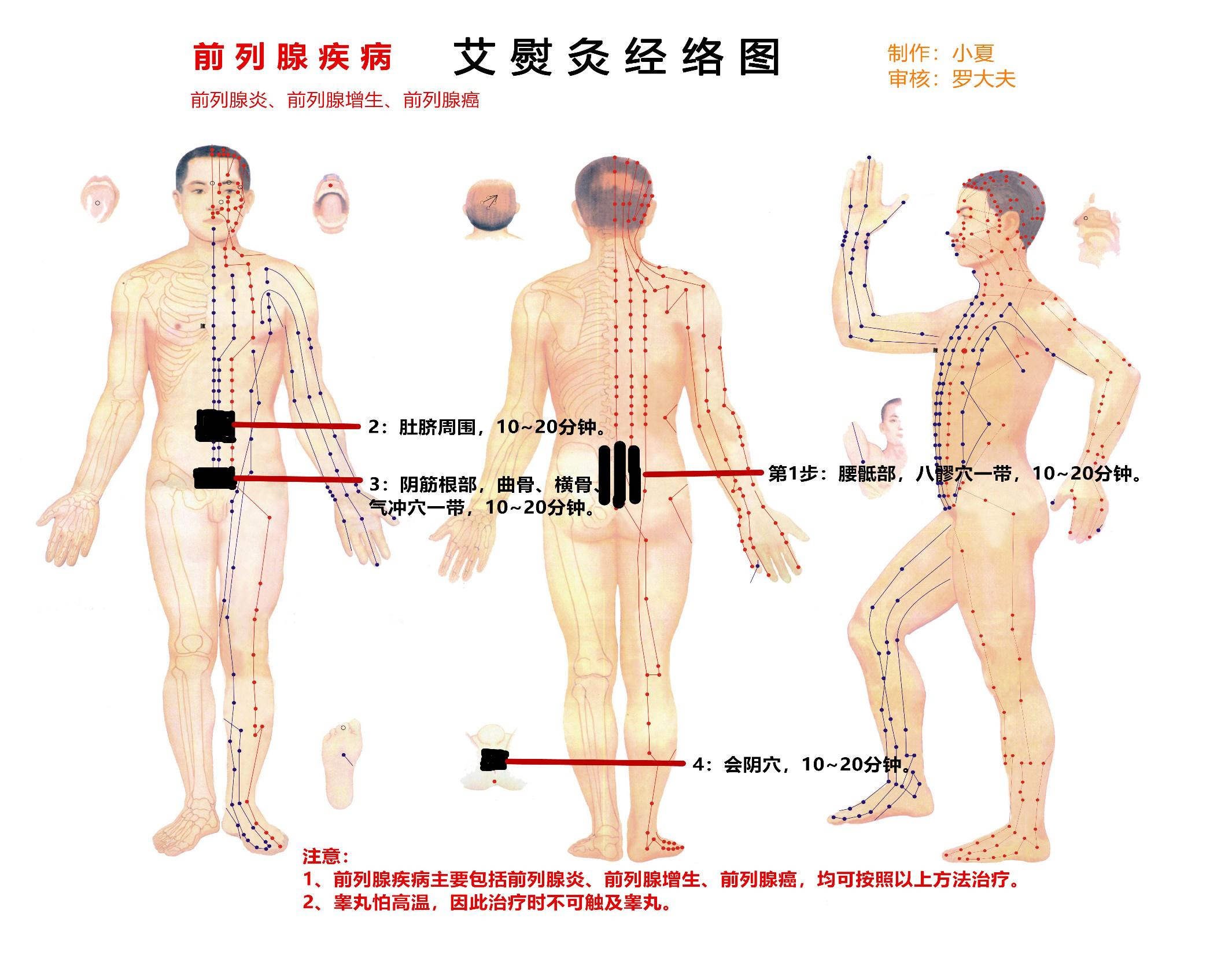前列腺增生82岁了能手术吗,103岁老人前列腺增生