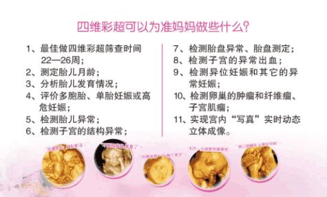 四维彩超宝宝不配合怎么办羊水少,四维产检宝宝不配合怎么办