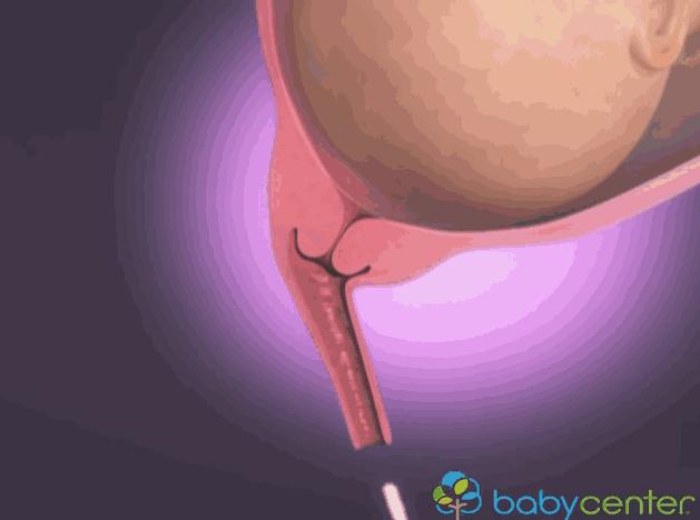 3d模拟受孕过程,3d模拟孕妇变化