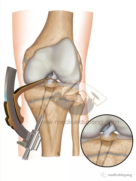 医学插画插图,医学插画sci