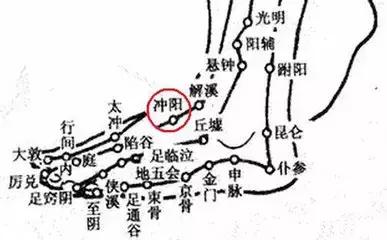 针灸治疼痛药方,针灸治疗各种痛症图解