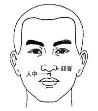 针灸治疼痛药方,针灸治疗各种痛症图解