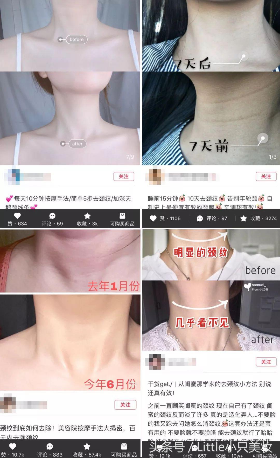 kazoo多肽颈膜手把手拯救颈纹,怎么拯救眼下细纹