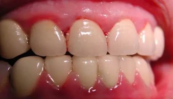 牙疼不是病痛起来要人命图片,牙疼不是病疼得要人命