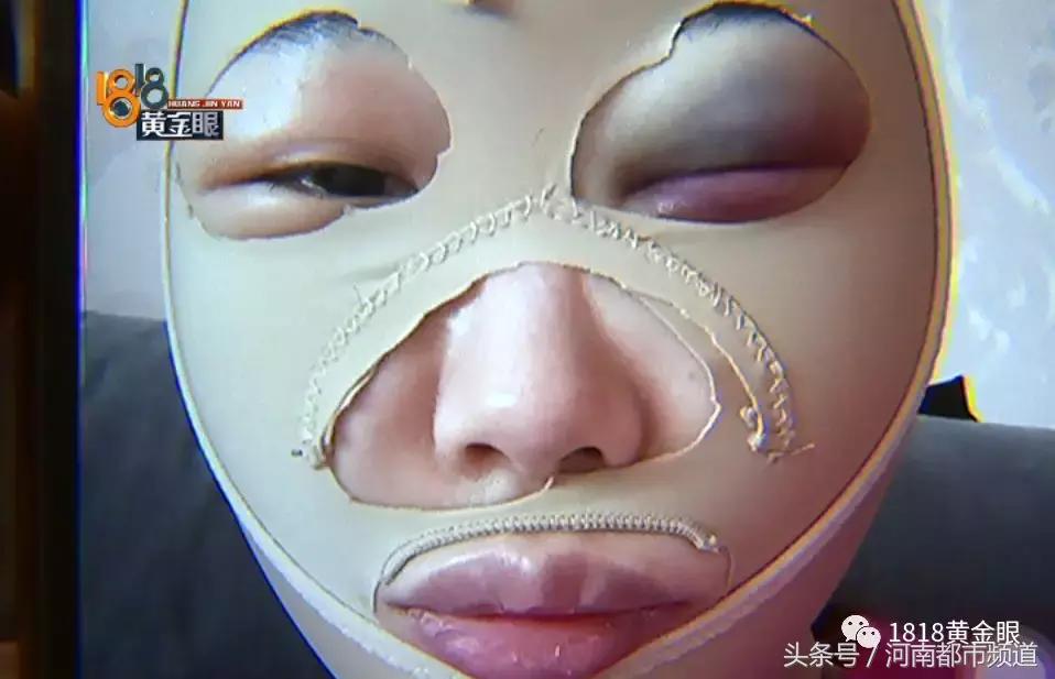 为什么我做溶脂瘦脸都没效果,溶脂瘦脸4天了没有效果