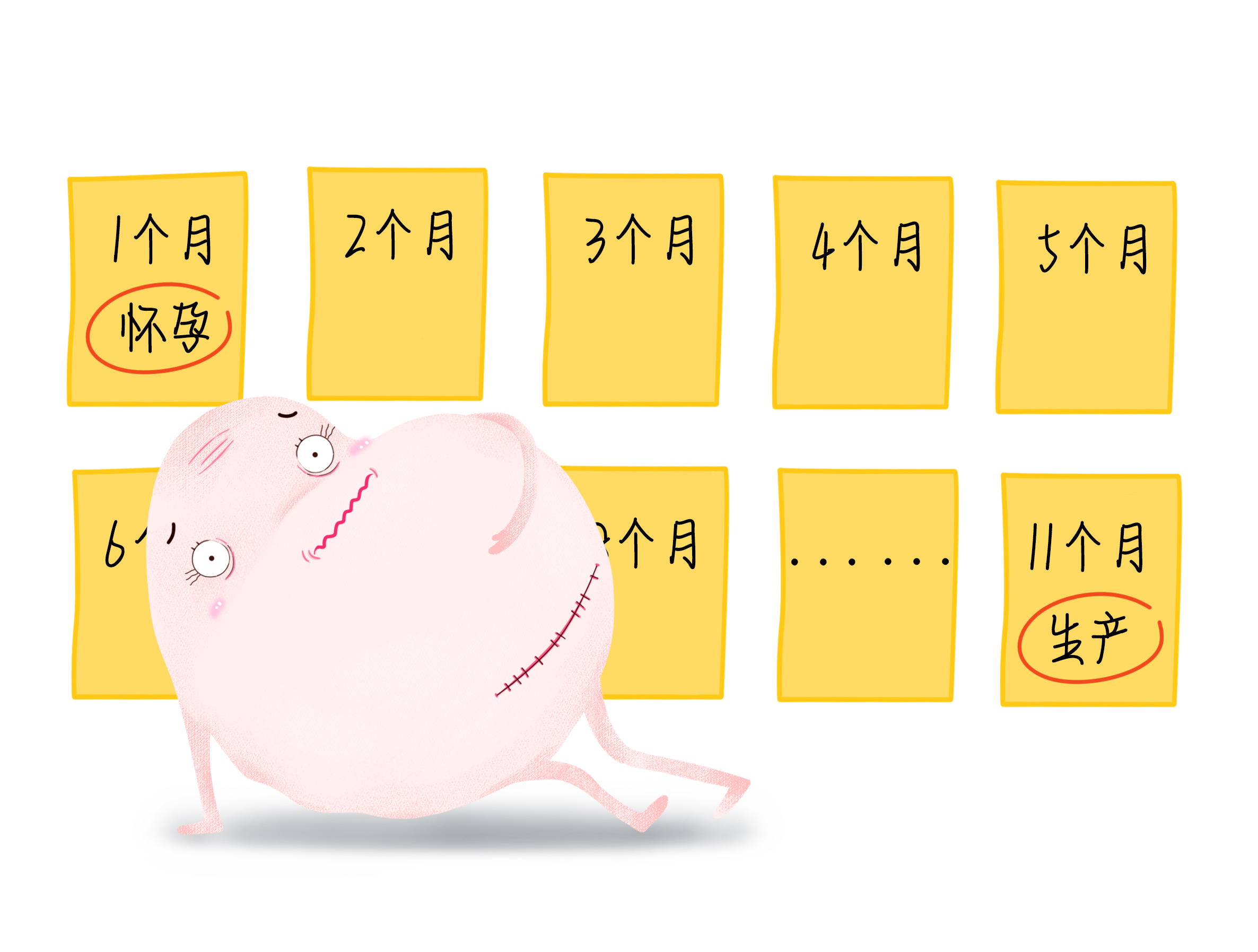 剖宫产科普漫画版,无痛分娩科普画