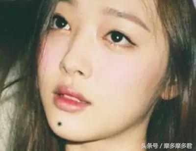 身体上的哪些痣代表富贵,一个人最富的三种痣