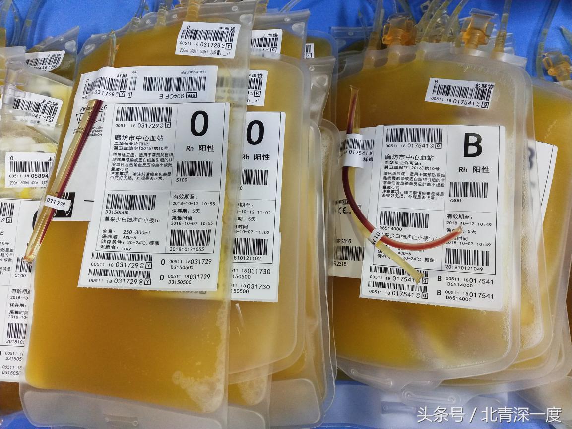 被误解的“熊猫血”：产妇不知自己是稀有血型18次怀孕失败