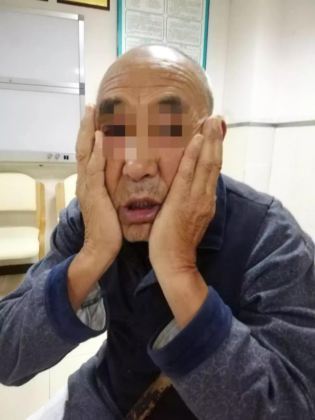 射频消融术治疗三叉神经痛,射频热凝治疗三叉神经痛成功案例