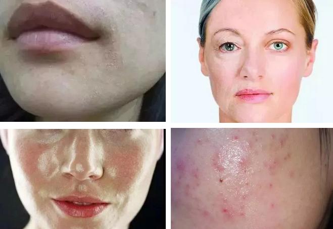 cosme大赏面膜使用方法,韩国cosme大赏排名第一的补水面膜