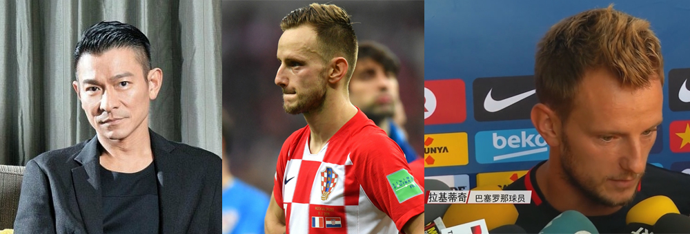 大卫席尔瓦为什么剃光头？