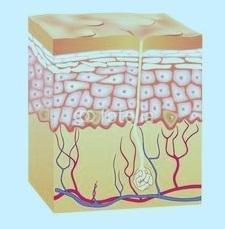 瘢痕疙瘩可以直接割下来吗,胸口瘢痕疙瘩最新治疗方法