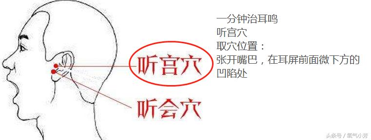 中医10个急救穴位图,10个急救穴