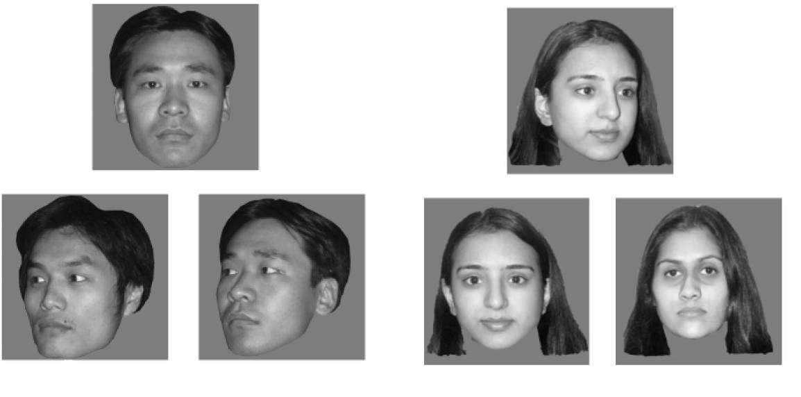 真正的脸盲症是什么,如何知道自己是否有脸盲症