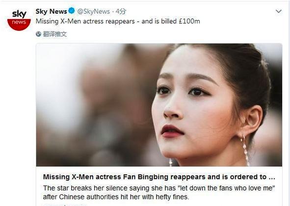 真正的脸盲症是什么,如何知道自己是否有脸盲症