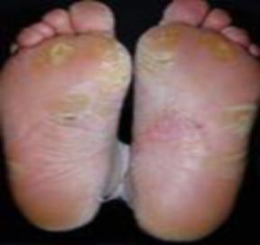 常见疾病与防治知识大全,100种常见病预防措施