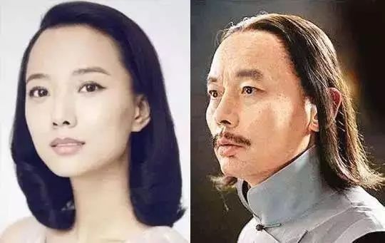 轻微m型脱发如何选择发型,头发脱发断发怎么拯救发量