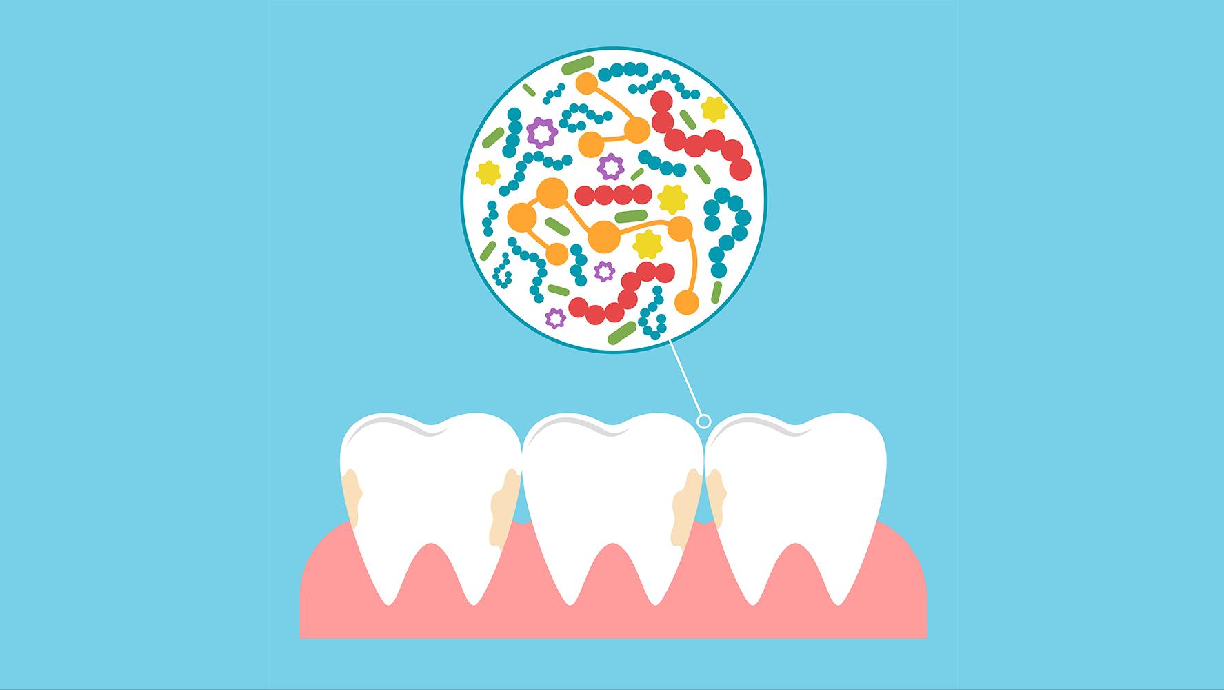 口腔细菌如何增殖,口腔细菌失衡如何处理