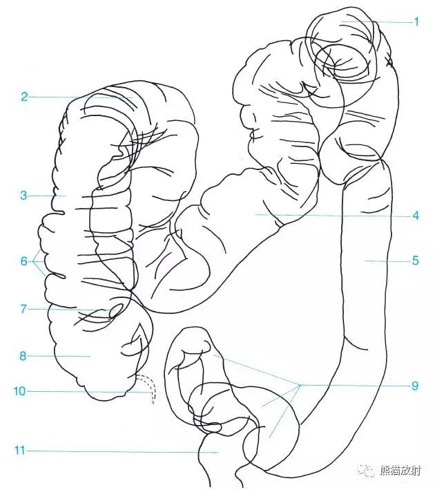 详细的消化道造影+彩色解剖图