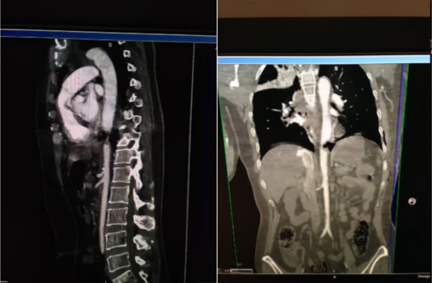 薛张纲教授,乳酸酸中毒临床指南