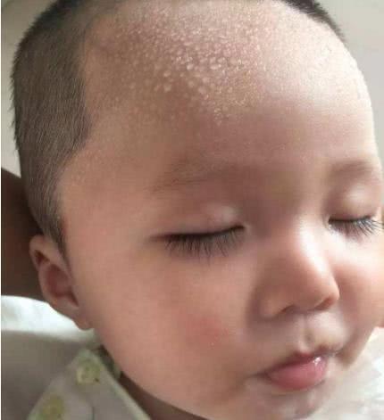 宝宝缺钙头部会大量出汗吗,三岁孩子头上出汗多是缺钙吗