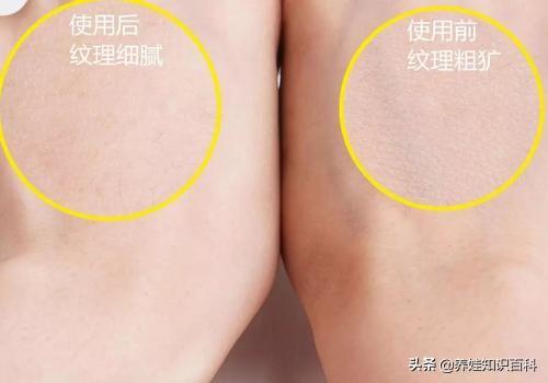 天天熬夜带娃瘦了,天天熬夜带娃也不见瘦