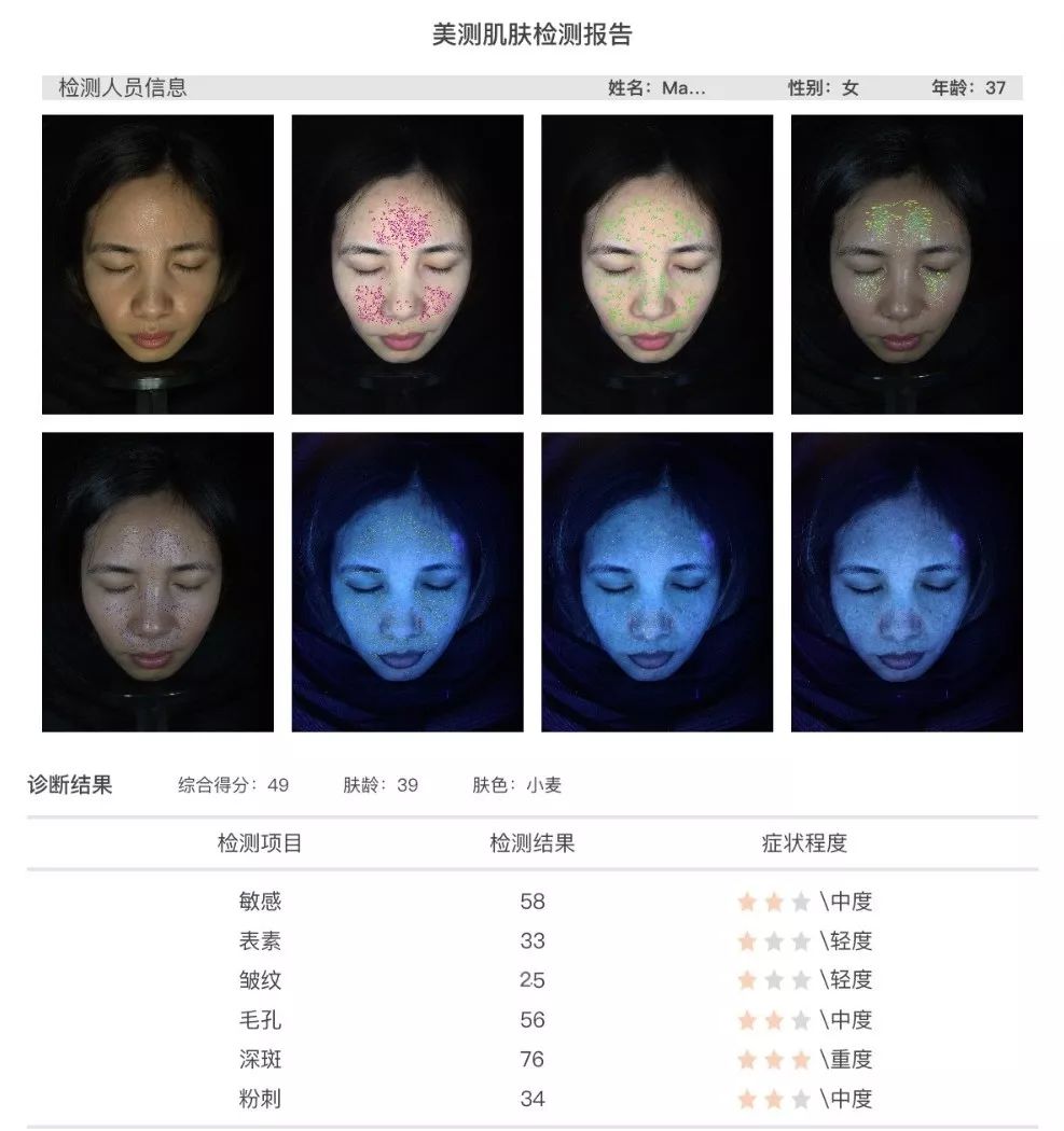 小茂肌诊室∣美容仪挑战：家用美容仪到底值得投资吗？