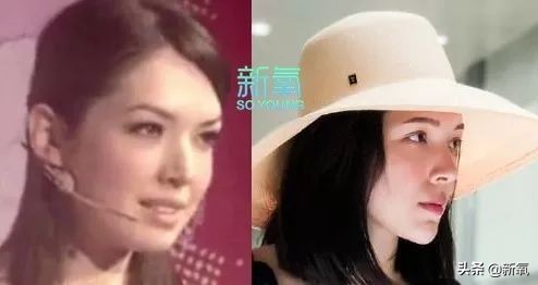 盘点整容后不敢认的女星颜值巅峰,知名女网红被扒整容