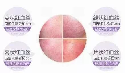 紫檀如何帮助人体抗衰老,紫檀能淡斑吗