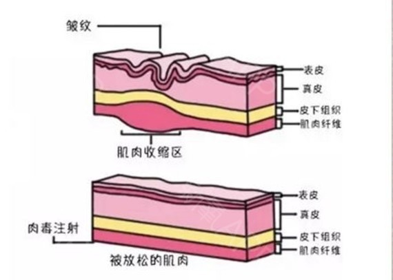 每个月花1000化妆品比不上医美吗？整形医生告诉你事实真相
