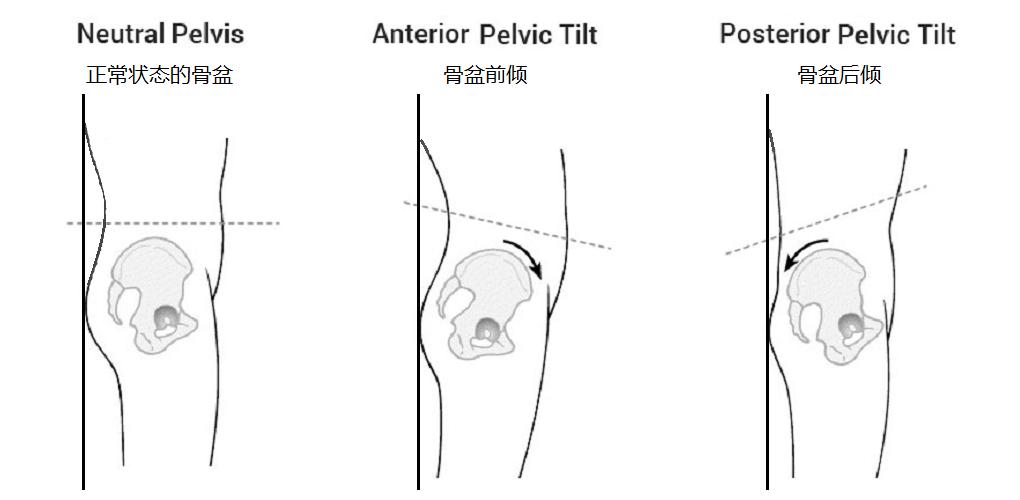 锻炼小燕飞后腰反而更疼了,练习小燕飞后腰胀是怎么回事