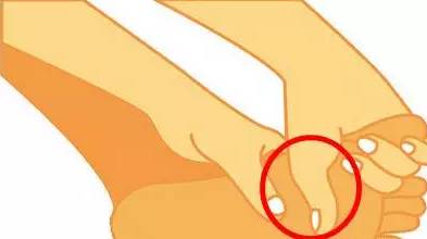 大脚趾外翻有什么可以治疗的,大脚趾外翻后遗症