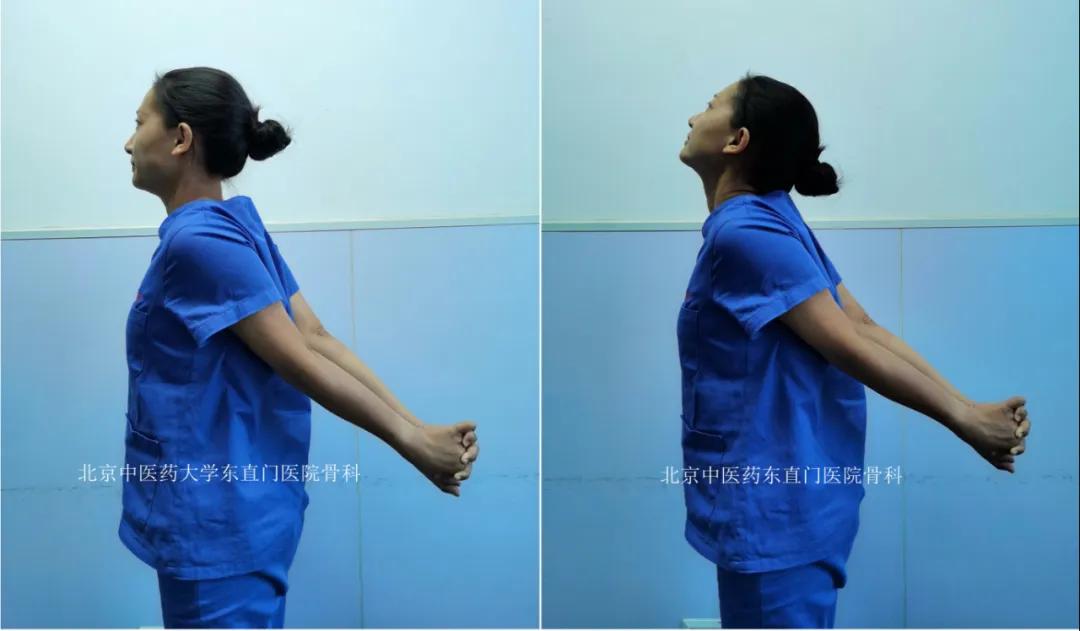 骨科医生腰痛缓解,一招教你根治腰背痛