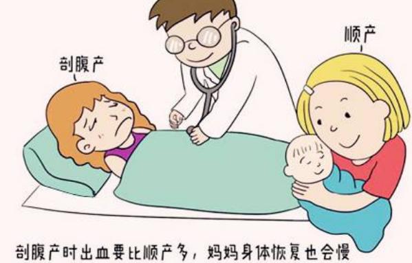 顺产？刨腹产？这是个问题！