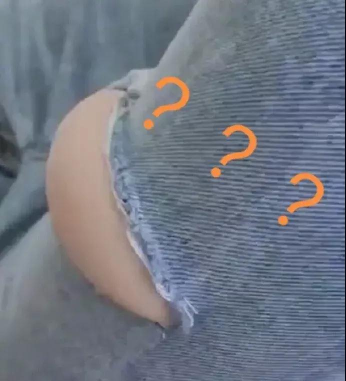 滑冰把膝盖内侧摔了怎么办,溜冰时膝盖磕破怎么办