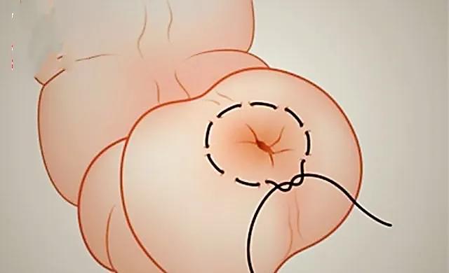 猪脱肛最快特效药,猪脱肛是什么病用什么药治疗