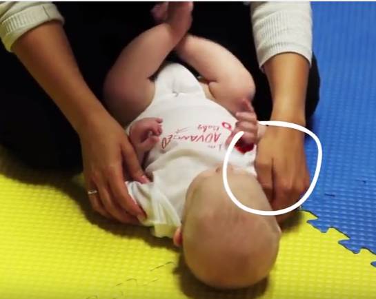 宝宝头总往一侧睡有点扁,新生儿斜颈按摩康复的几率有多大