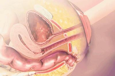 ella自曝产后后遗症,ella自曝产后尿失禁