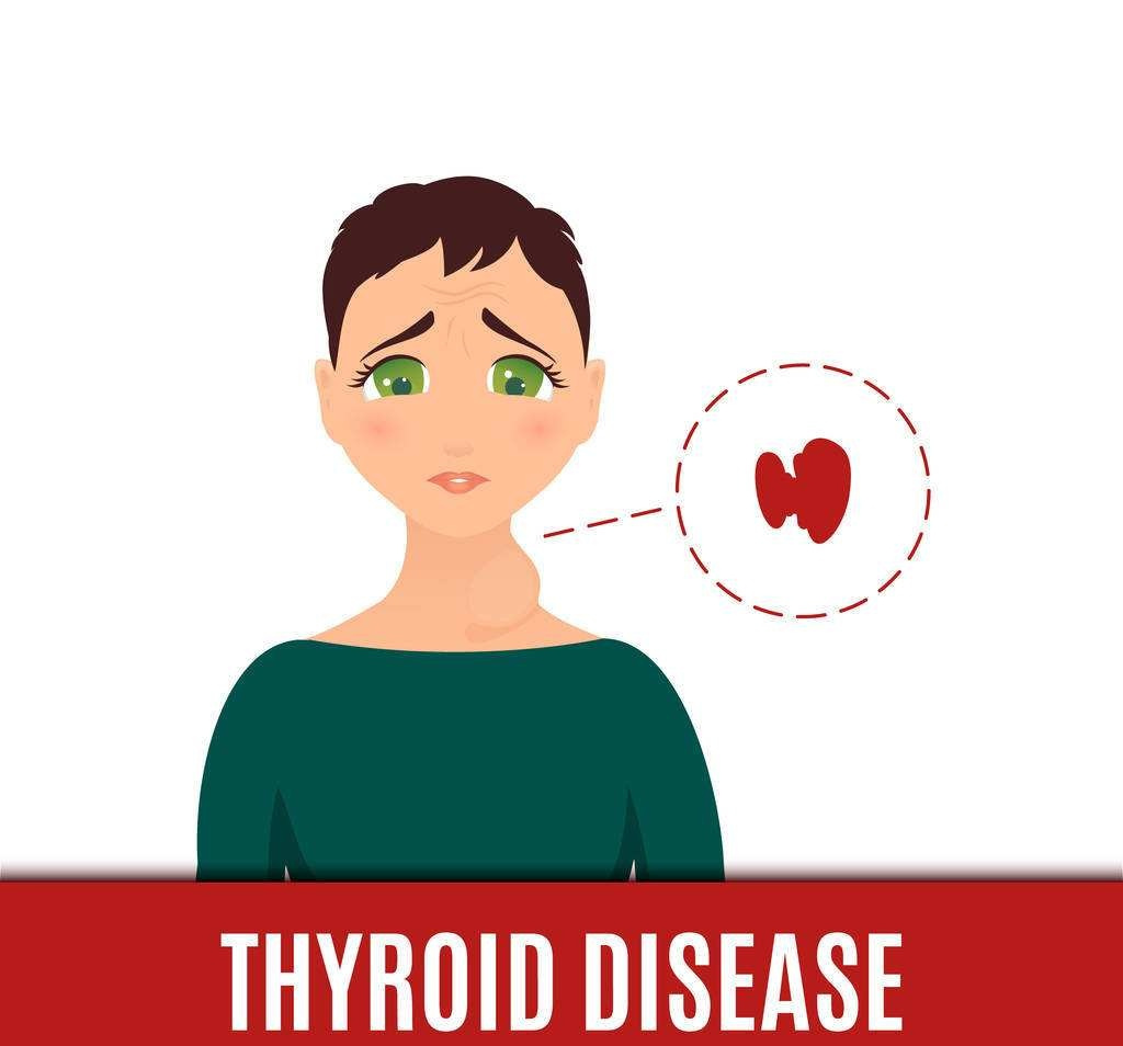 如果有甲状腺身体会出现什么反应,甲状腺患者出现4种情况