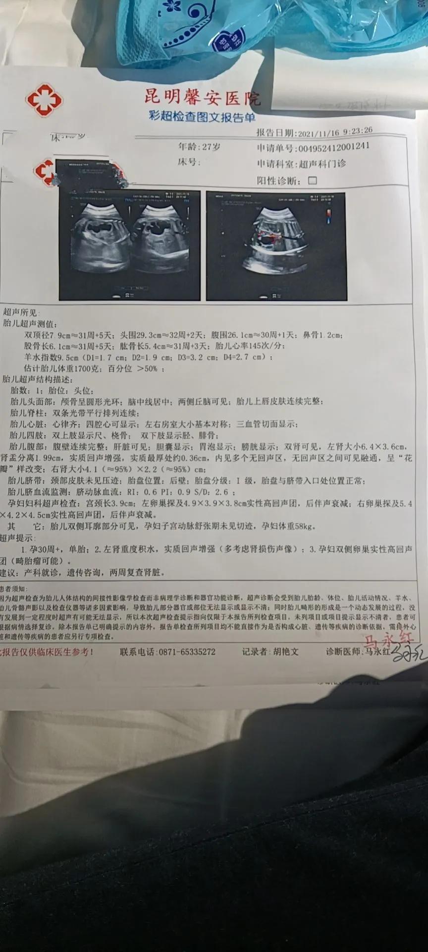 脐血穿刺的过程,脐血穿刺痛苦吗